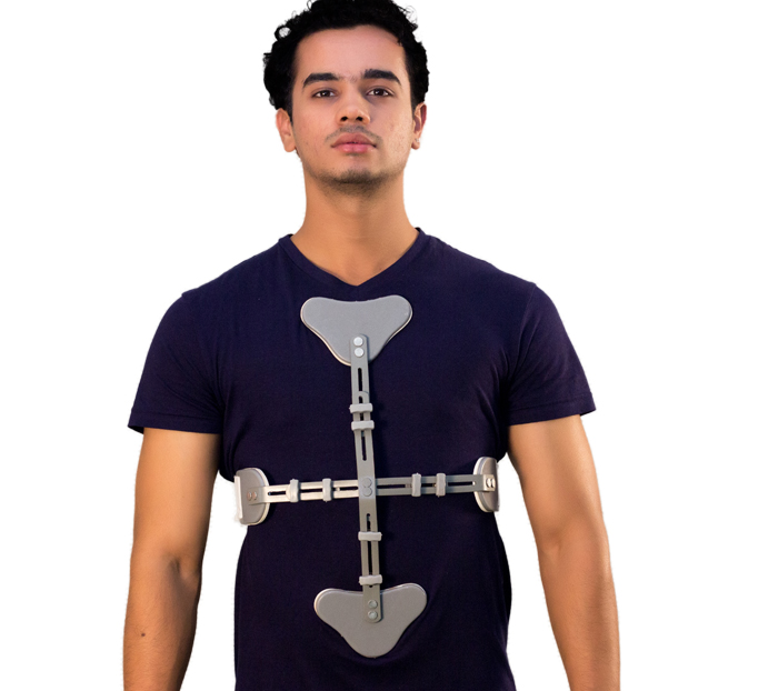 CASH Thoracic Spine Hyperextension Brace for Fractures